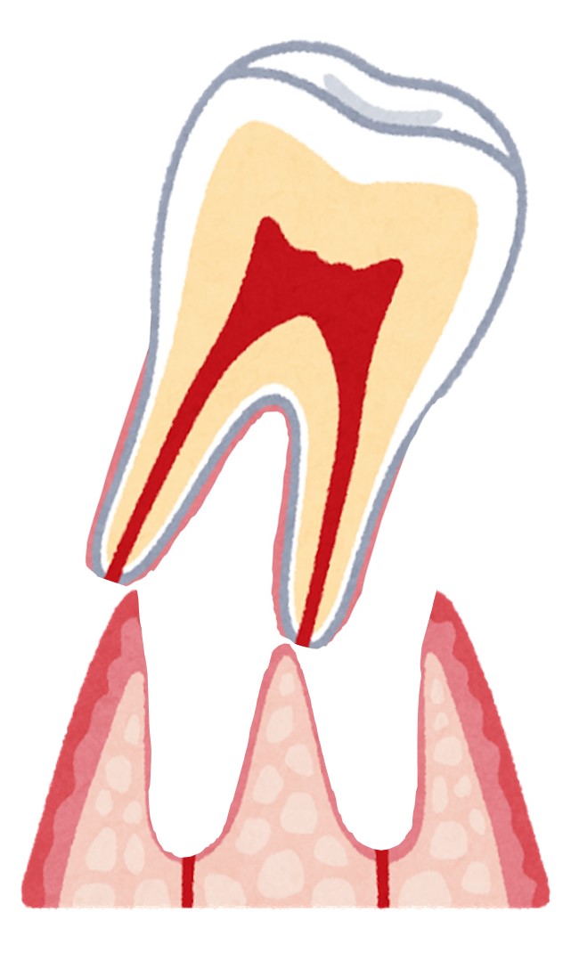 歯の脱臼 大杉歯科医院 寝屋川市萱島の歯医者 歯科口腔外科 をお探しなら当院へ